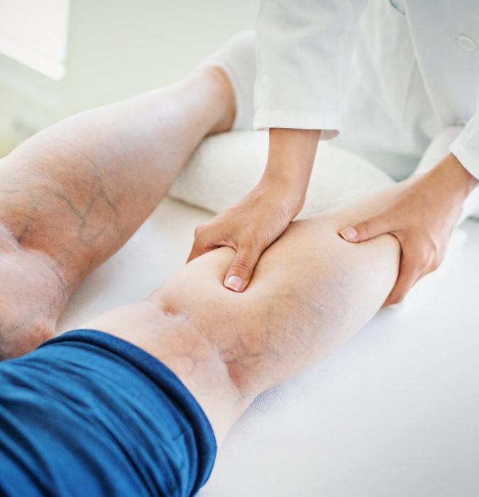 Vein care doctor analyzing their vein patient on the table